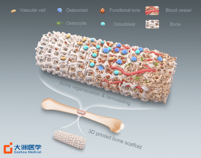 產(chǎn)品&解決方案-詳細(xì)大圖-人工骨.png